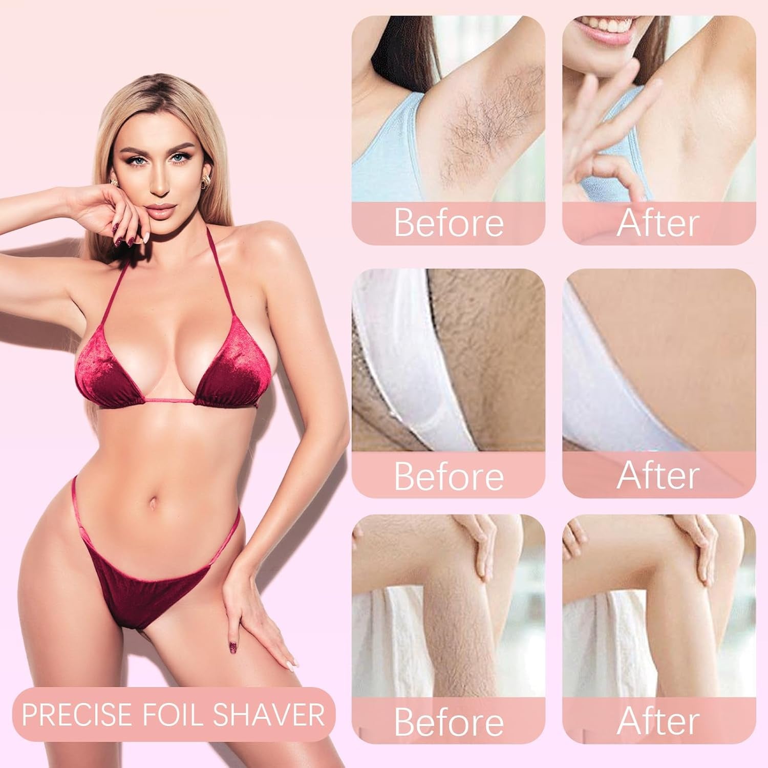 Dermavee 1